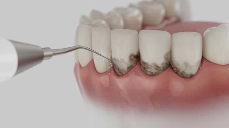 Trusted Teeth Cleaning And Checkup service in Mojave, CA - Dentist Open Now